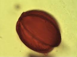 Image result for Berlinia