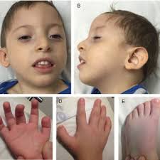 Doris PINTO-ESCALANTE