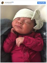 Check spelling or type a new query. Fans Duggar Baby Has Subconjunctival Hemorrhage Birth Injury Guide