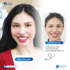 Nha Khoa Paris