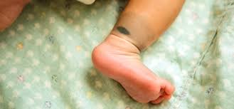 Birthmarks, the Chinese Take: A Kiss From an Angel or a Mark of the Devil?  | the Beijinger