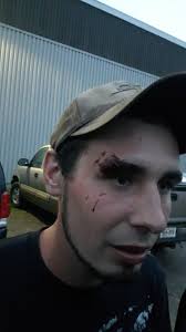 Hockey player Colin passes away and donates organs