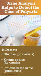 Image result for Polyuria