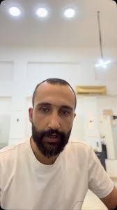 “مش كل اللي في العبوة علاج… ومش كل اللي في الصيدلية هينقذ شعرك!, اللي هيطور  شعرك ويحافظ عليه مش الكوزماتيكس…, اللي هيعمل كده هو الدكتور الكوافير اللي  فاهم فروة شعرك قبل أطرافه 👨‍⚕️💇‍♀️, بيبو أمير… ...