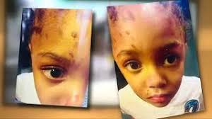 Image result for aniya day garrett autopsy photos