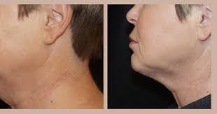 Desired Beauty Surgical & Medical Center