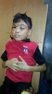 Budak Maut Jatuh Bangunan Di Klang Adalah Palsu Utaranews Com