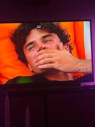 Speculation about Rick's broken nose