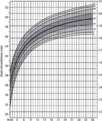 info head circumference guws medical