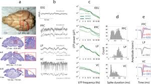 Check spelling or type a new query. Transcranial Alternating Current Stimulation Entrains Alpha Oscillations By Preferential Phase Synchronization Of Fast Spiking Cortical Neurons To Stimulation Waveform Nature Communications
