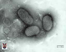 The monkeypox virus can affect humans and certain animals. Robert Siegel Virus Human Viral
