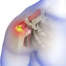 Image result for Rotator Cuff Injury
