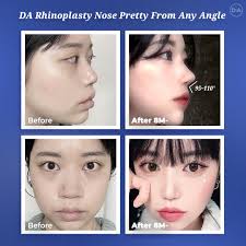 Amazing DA Results!✨ Enhance Your Beauty and Be More Confident!💕 Find your  inner beauty and outer beauty with DA 💖 Visit DA Plastic Surgery &  Dermatology🥰 For more information, DM us or