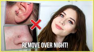How To Get Rid Of Piercing Bumps Overnight Youtube