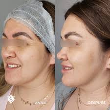 Sinag Medicina Estética