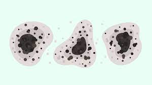 Maybe you would like to learn more about one of these? Que Es El Hongo Negro Y Por Que Preocupa En Pandemia Salud Con Lupa