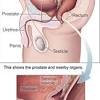 In addition to the usual signs of prostate problems, prostatitis in dogs can also cause vomiting, fever, weakness and weight loss. 1