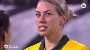 Alanna Kennedy Broken Nose Video Reaction and Edit Resurfaced