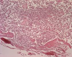 Das bedeutet, dass die toxine, die den blutkreislauf der mutter durchlaufen haben. Mephisto Histologische Praparate Urogenitalsystem Plazenta