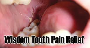 Not only will this relieve some of the pain, but it will also help the inflammation go down. Remedy For Wisdom Teeth Pain Teethwalls