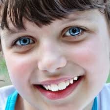 Child Teeth Crowding