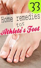 Home Remedy Hacks 33 Home Remedies For Athlete S Foot Foot Fungus Remedies Foot Remedies Athletes Foot