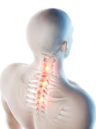 The human back anatomy is the powerhouse of the entire body, supporting the trunk and making the movement of the. Conceptual Digital Illustration Of Upper Back Pain In Transparent Human Silhouette 3d Head Stock Photo 308615856