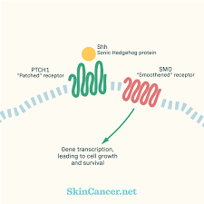 What type of skin cancer is hereditary? Skin Cancer Causes Genetic Mutations Skincancer Net