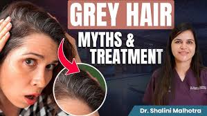 Grey Hair ka Ilaj