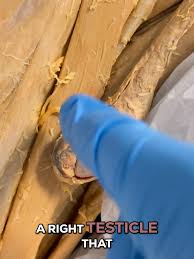 Image result for Cremasteric Reflex