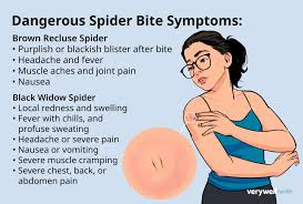 Image result for wolf spider bite skin