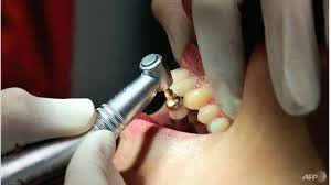 We did not find results for: Masalah Gusi Teruk Mungkin Tanda Kencing Manis Kajian Berita Mediacorp