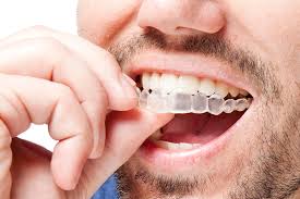 Make your dental health perfect with the best dentists near you. Invisalign In Garden Grove Clear Braces Orange County Orthodontics