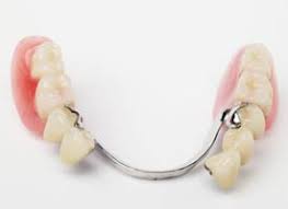 7 surgical tooth removal (including bone): Partial Dentures Costs Types Benefits Dds Dentures Implant Solutions