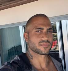 Последние твиты от josé carlos pereira (@carlaofc1971). Namorado De Rita Pereira Faz Implante Capilar Na Turquia Saiba Quanto Custa