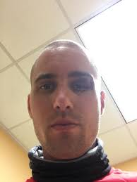 Tattoo superstition in disc golf tournaments