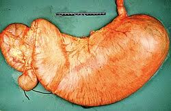 Image result for Succussion Splash