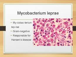 This is done just with a slide, a microscope, and stains. Mycobacterium Tuberculosis Klebsiella Pneumoniae Legionella Pneumophila Mycobacterium Leprae