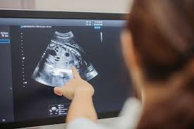 What To Expect At Your 12 Week Ultrasound