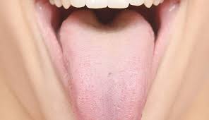 Dark (also generically known as black) spots on the tongue can sometimes indicate serious conditions. What Does Our Tongue Tell Us About Our Liver Liversupport Com