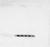 20- Deoxyingenol attenuate morphine-induced hippocampus ...