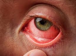 Consult drug interactions database for more information. Ivermectin Side Effects Dosage Uses And More