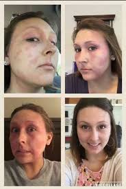 Hello Lovely people! It's a beautiful sunny day here in Devon, but also  very cold! I often find my skin struggles this time of year because of it.  Soothe is my saviour!