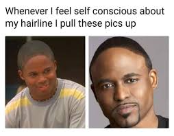 What are some of the jokes about short. Sen Ø¹Ù„Ù‰ ØªÙˆÙŠØªØ± Trick2g Any Time Those Hairline Jokes Get You Down Remember People Got It Worse Fam