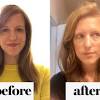 Even a trichologist may not be of much help for treating postpartum hair loss. 1