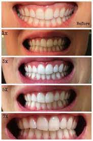 Crest 3d White Brilliance Daily Cleansing Whitening System