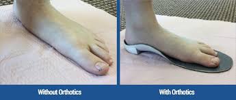 Image result for Orthotic