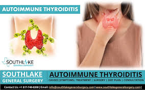 Image result for Thyroiditis