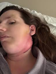 Can we still take our injection if we are sick