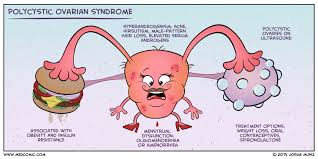Polycystic ovary syndrome (pcos) affects how the ovaries work and is linked to a hormone. Polycystic Ovary Syndrome Pcos Pcod Medsphere
